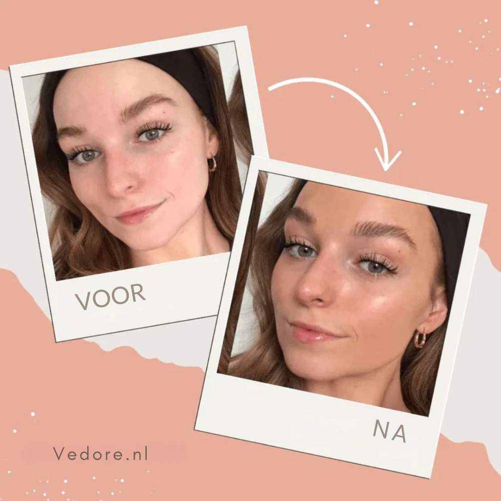 SUNNYDROPS | 40% Vakantie Korting